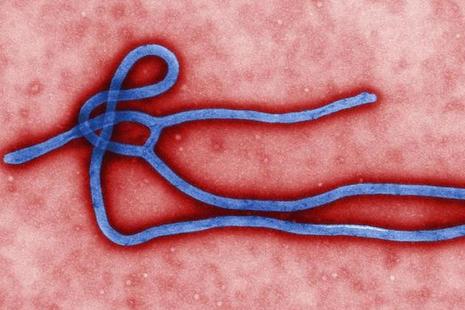 Ebola Virus Disease
